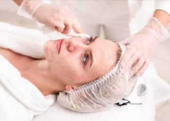 What is the best treatment for pimples?