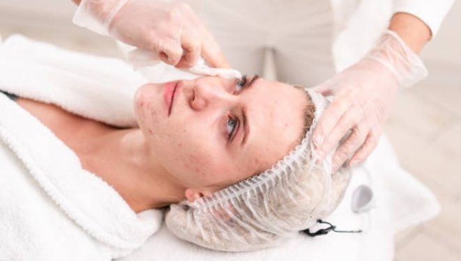 What is the best treatment for pimples?