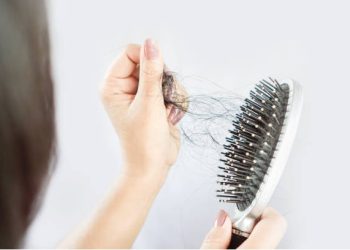 Everything You Need to Know About Hair Transplants