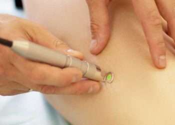 All you need to know before getting treated by radiofrequency ablation!