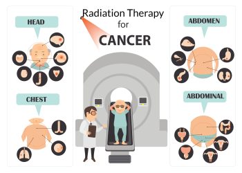 Side effects of radiation therapy
