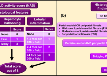 Chronic Liver Disease (CLD) Therapeutics Include Liver Biopsy to Collect Tissue Samples of Liver Damage, Limiting Liquor Intake, and Consumption of Antibiotics