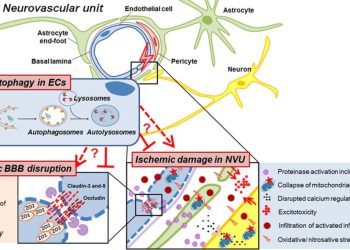 Interventional Neurology Helps in Treating Conditions like Stroke, Ischemic Stroke, and Multiple Sclerosis