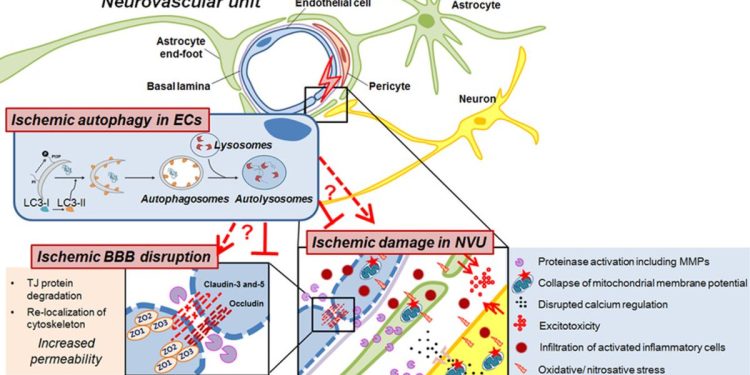 Interventional Neurology Helps in Treating Conditions like Stroke, Ischemic Stroke, and Multiple Sclerosis