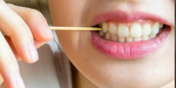 Home remedies for bleeding gums
