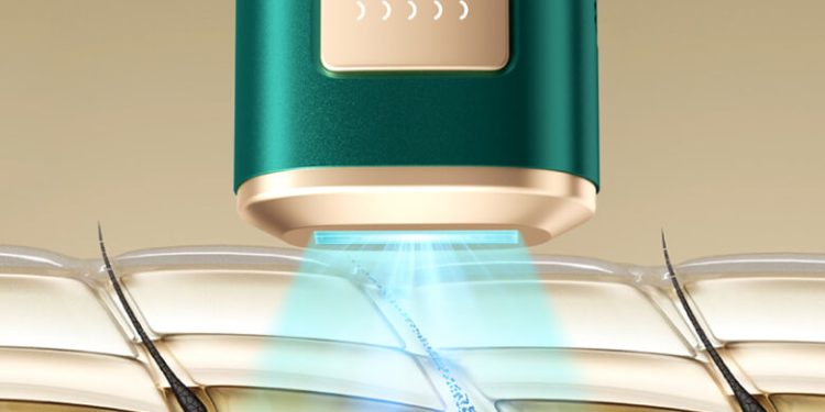 Decoding Ulike Laser IPL Hair Removal: Understanding Permanence