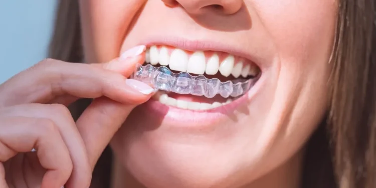 Invisalign in London: Aligning Teeth, Boosting Confidence